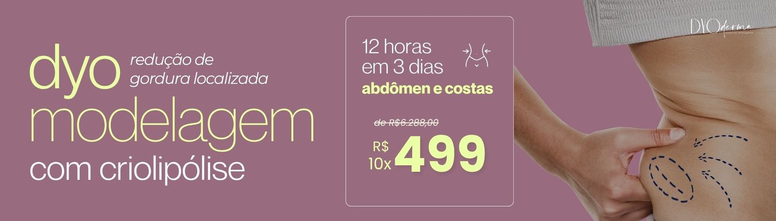 Dyoderma Promo Banner