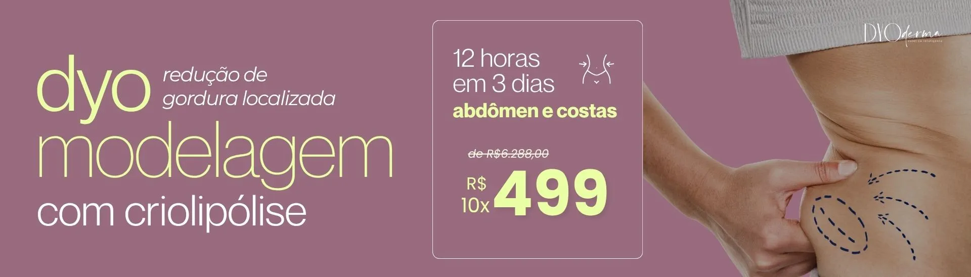 Dyoderma Promo Banner